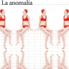 LA ANOMALÍA
